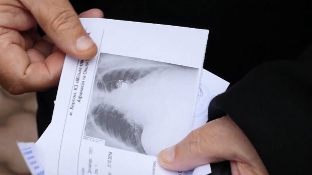 Кричав та штовхався: у Херсоні чиновник влаштував бійку з громадянами, які прийшли на прийом