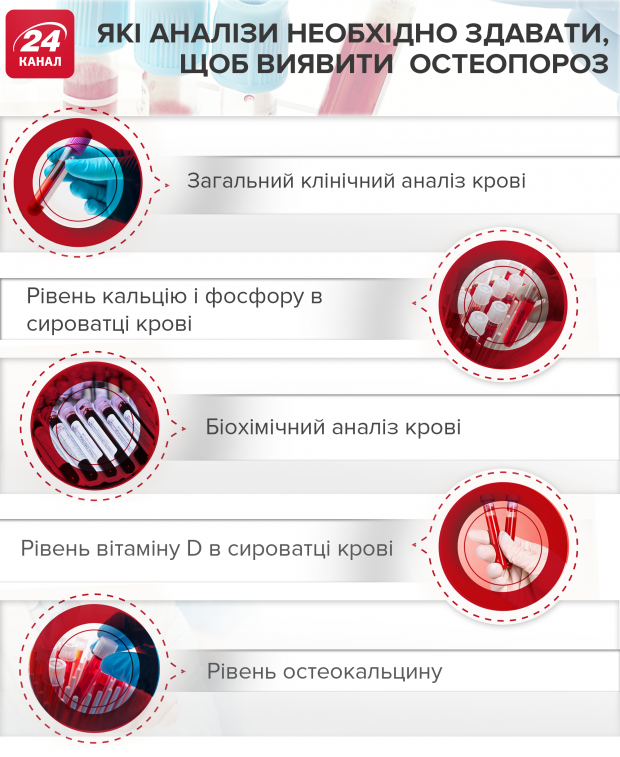 Остеопороз: причини, аналізи, лікування та профілактика