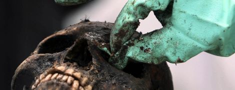 Ученые нашли в ядовитом озере новый вид червя с тремя разными полами и кенгуриным мешочком
