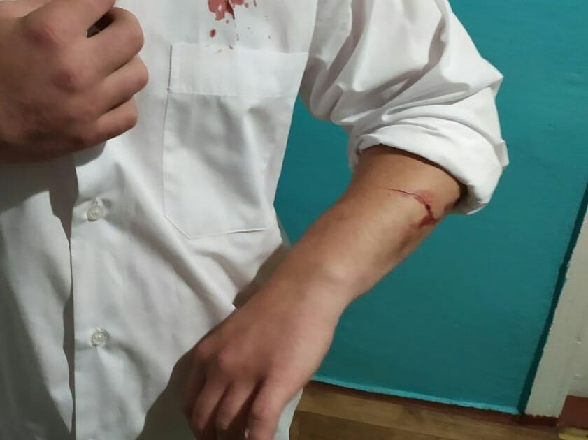 В Хмельницкой области кандидата в нардепы ударили ножом в грудь